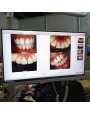 Dentalisches WLAN All-in-One-Intraorale Camera mit 24-Zoll-Touchscreen